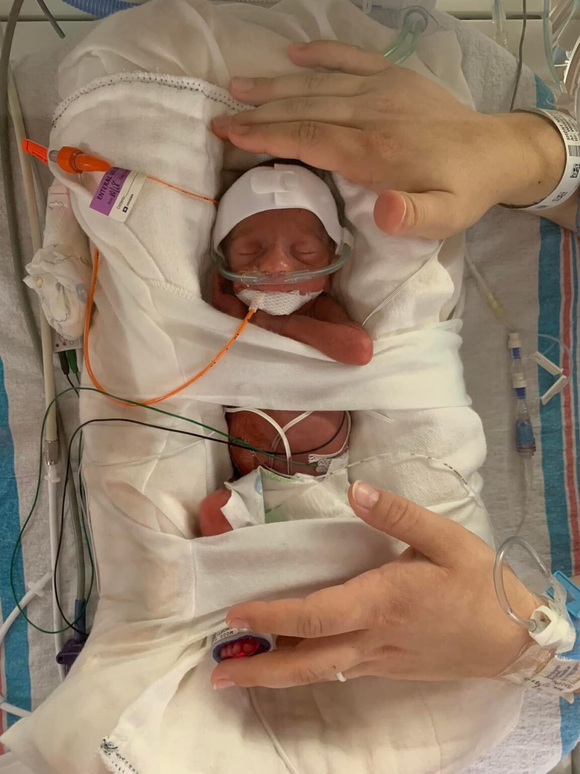 baby nicu